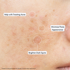 NUT BOTANICALS Eternity Spring Niacinamide and Hyaluronic Face Cream - ZYNAH: Shop online for beauty products in Egypt