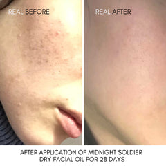Nut Botanicals Midnight Soldier Facial Dry Oil