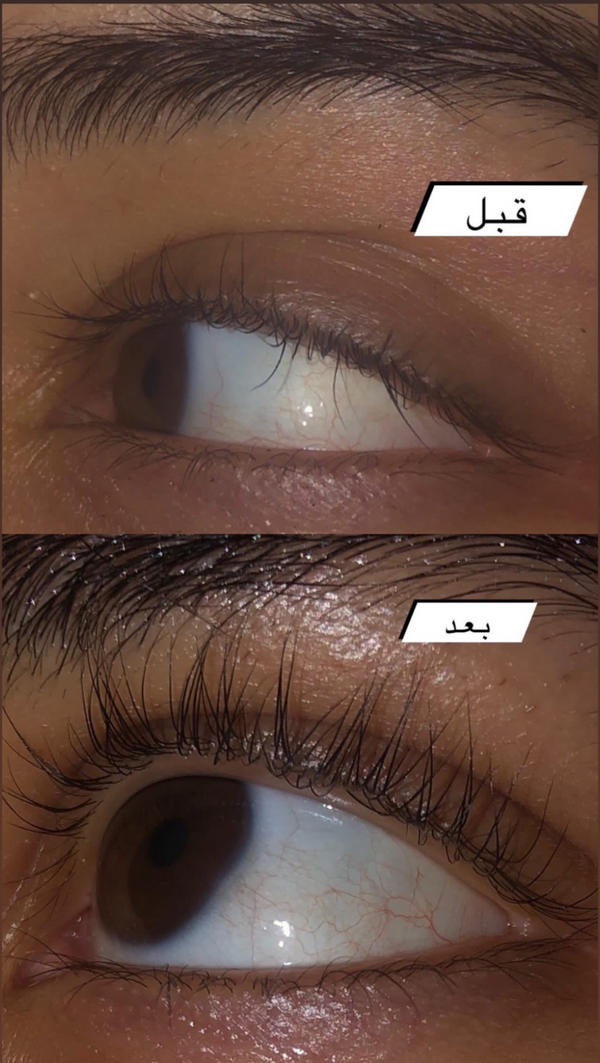 Follicle Booster Eyelash Edition Raw African on ZYNAH