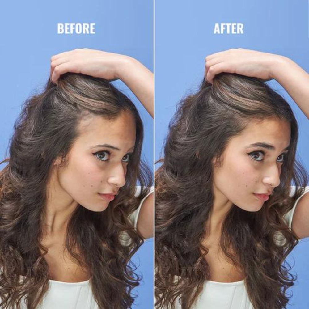 Locken Rooting For You Hair Follicle Activator