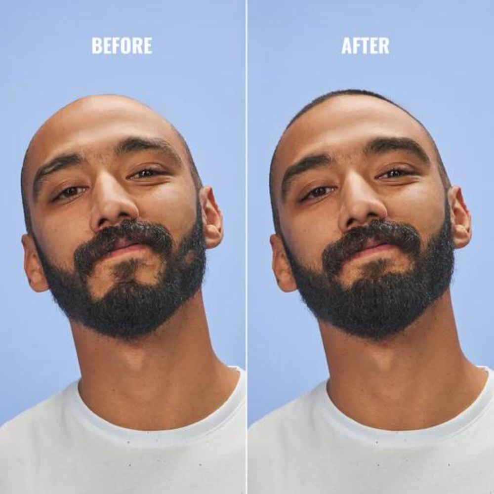 Locken Rooting For You Hair Follicle Activator