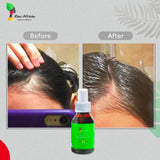Follicle Booster Hair Oil by Raw African - before and after - shop on ZYNAH Egypt