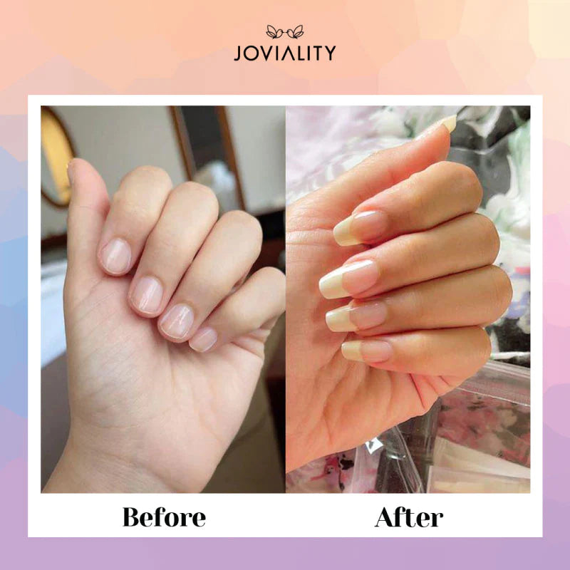 Strong n' Long Nourishing Nail & Cuticle Oil by Joviality on ZYNAH Egypt
