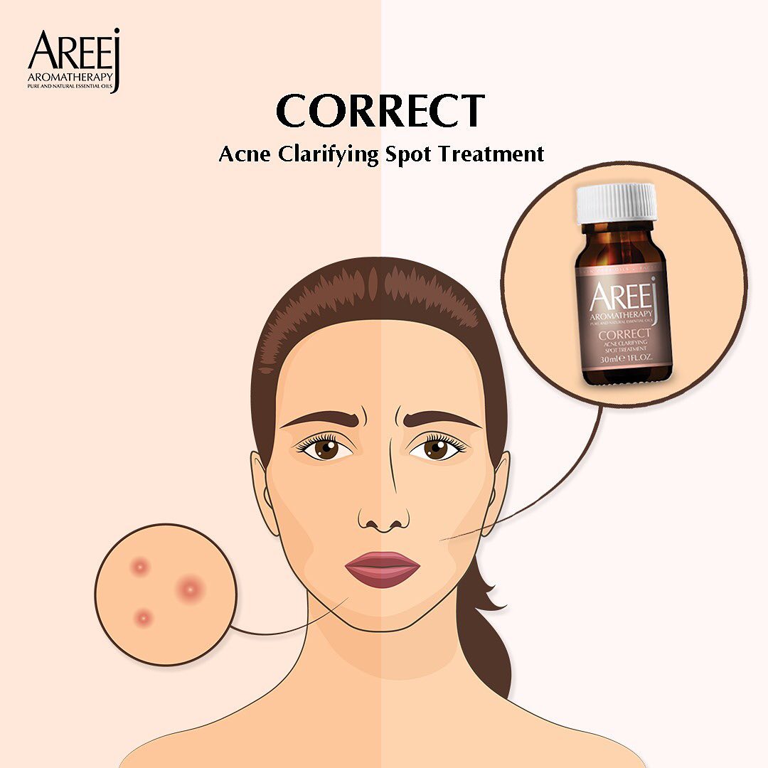 Correct Acne Treatment by Areej Aromatherapy - ZYNAH: Shop online in Egypt for beauty products - skincare, makeup, hair, clean beauty