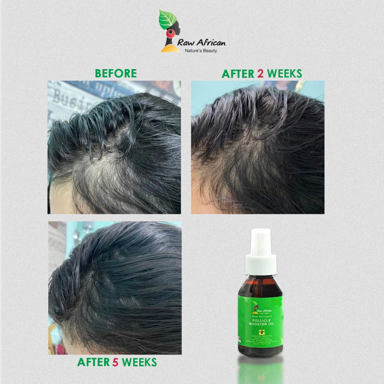 Raw African Follicle Booster on ZYNAH Egypt